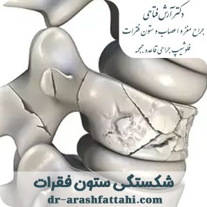 شکستگی ستون فقرات -دکتر آرش فتاحی - dr-arashfattahi.com