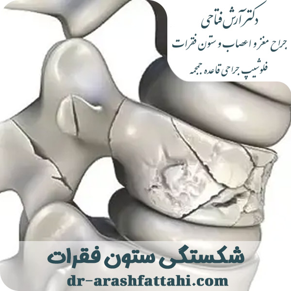 شکستگی ستون فقرات -دکتر آرش فتاحی - dr-arashfattahi.com