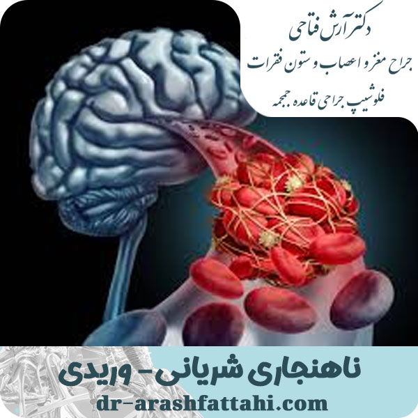 ناهنجاری سریانی وریدی- دکتر فتاحی - dr-arashfattahi.com