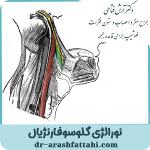  نورالژی گلوسوفارنژیال- دکتر آرش فتاحی - dr-arashfattahi.com