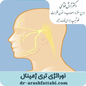 نورالژی عصب سه‌قلو - دکتر آرش فتاحی - dr-arashfattahi.com