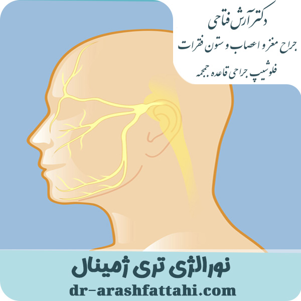 نورالژی عصب سه‌قلو - دکتر آرش فتاحی - dr-arashfattahi.com