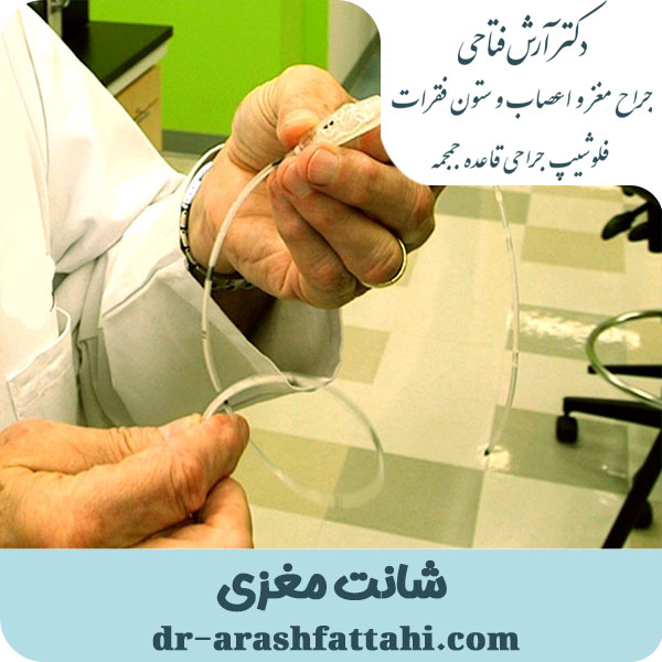 شانت مغزی - دکتر آش فتاحی - dr-arashfattahi.com