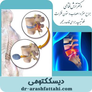 جراحی دیسک کمر و گردن - دکتر آرش فتاحی - dr-arashfattahi.com