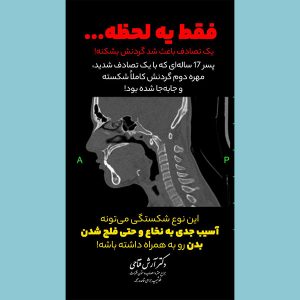 شکستگی گردن - دکتر آرش فتاحی - dr-arashfattahi.com