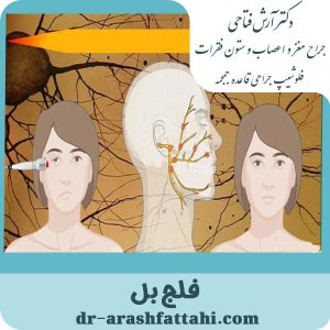 فلج بل - دکتر آرش فتاحی - dr-arashfattahi.com