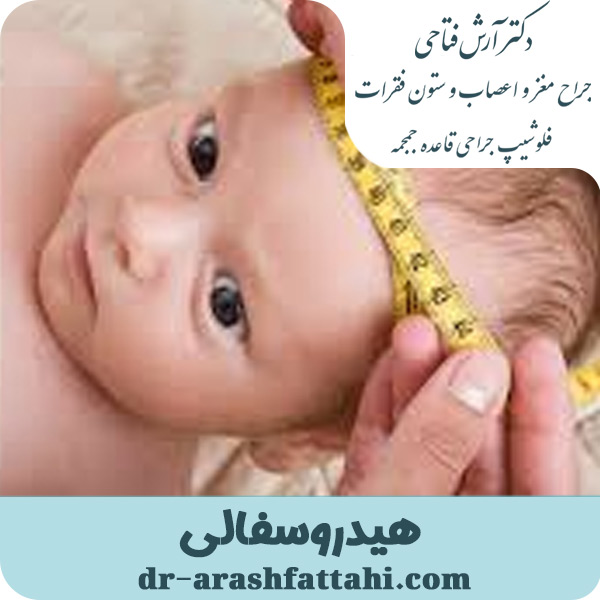 هیدروسفالی - دکتر آرش فتاحی - dr-arashfattahi.com