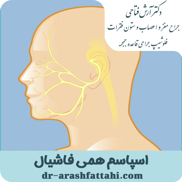 اسپاسم همی فاشیال - دکتر آرش فتاحی -dr-arashfattahi.com
