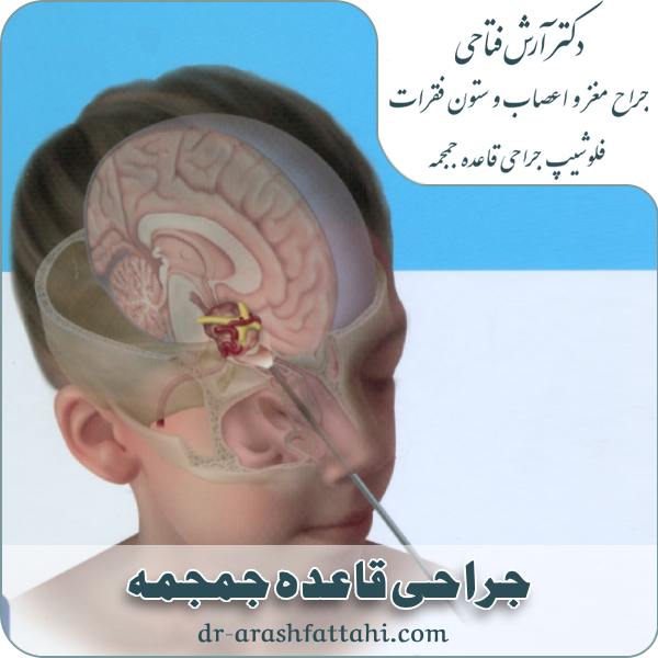 جراحی‌ قاعده جمجمه