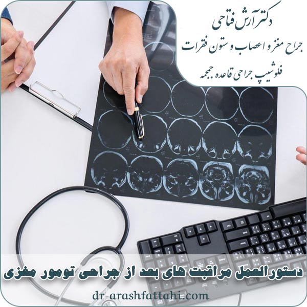 دستورالعمل مراقبت های بعد از جراحی تومور مغزی (بایدها و نبایدها)