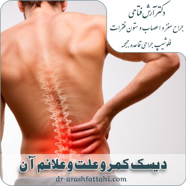 علت بیماری دیسک کمر چیست؟ علائم و تشخیص دیسک کمر